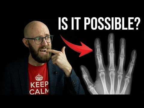 Can You Actually Bite Through Your Own Finger?