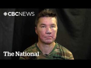 CBC News: The National – Ukrainian hockey player injured in war longs to return to game he loves